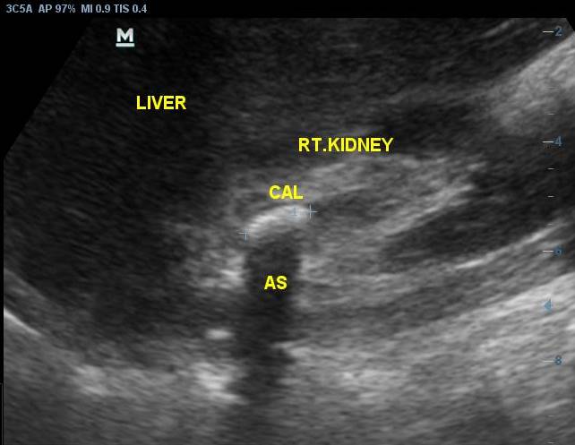 Ultrasound Scan 2